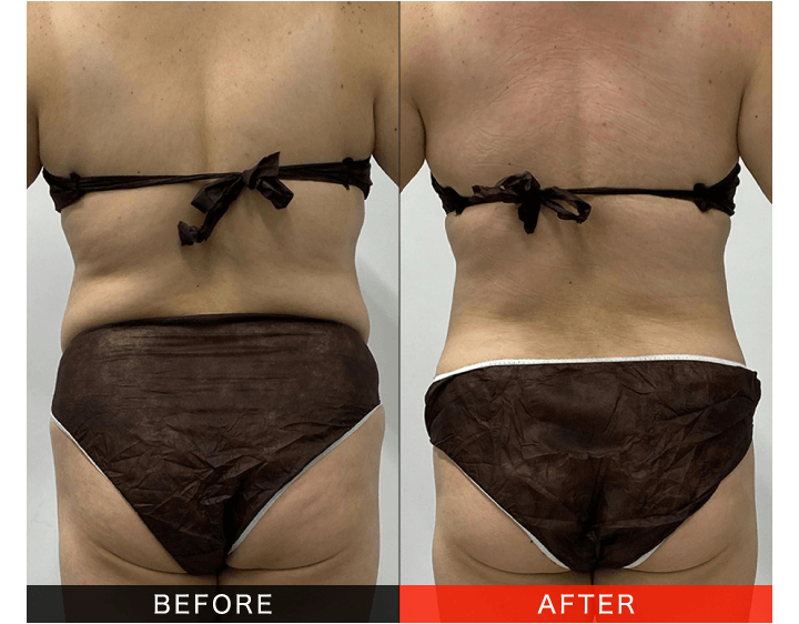 3750　こちらは専用です SUPER73 ディスプレイ Upgrade Your ZX Bike With Storage Accessories